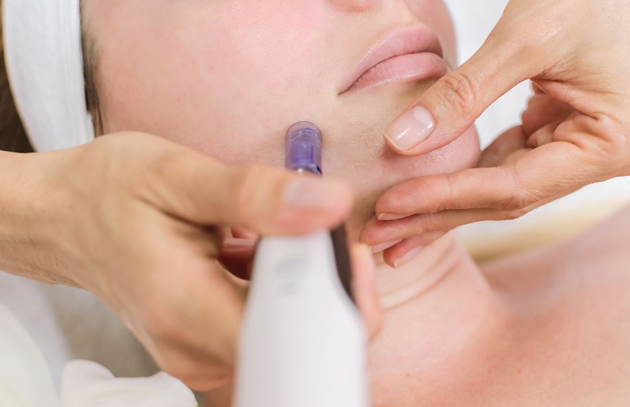 Dermapen uygulama aşaması