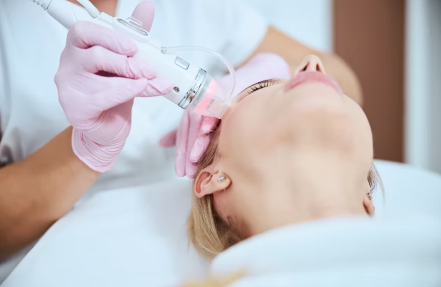 Yüz bölgesi dermapen uygulaması